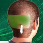 مرحلة تخدير المنطقة المانحة قبل زراعة الشعر في مصر