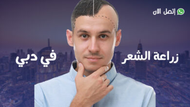 تكلفة زراعة الشعر في دبي