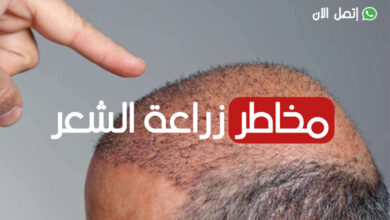 مخاطر زراعة الشعر